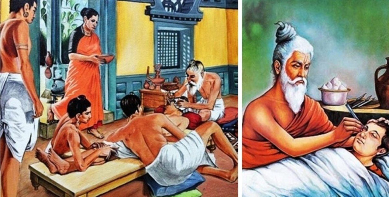 Chirurgiens indiens traditionnels