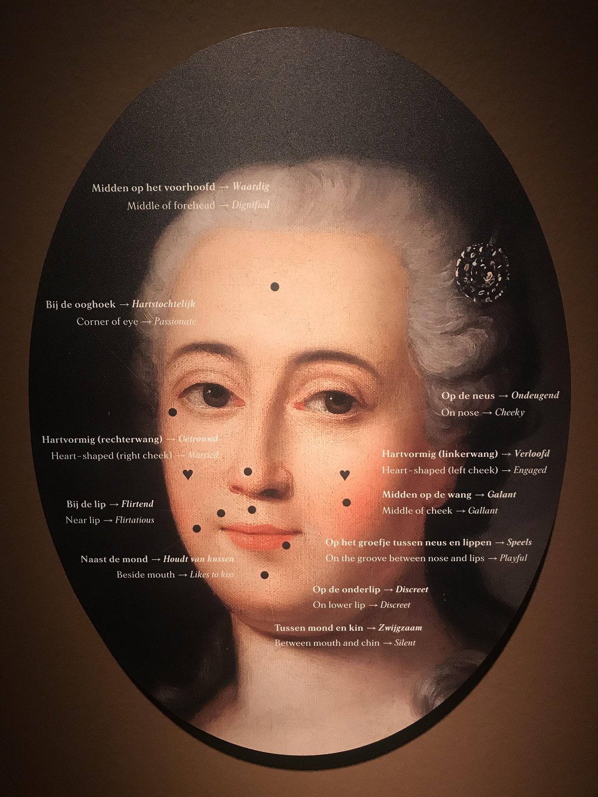 Schéma ABCDE des grains de beauté — critères de surveillance